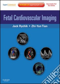 Fetal Cardiovascular Imaging E-BookExpert Consult Premium. E-book. Formato EPUB ebook di Jack Rychik