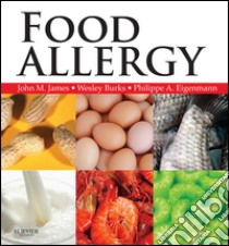 Food Allergy E-BookExpert Consult Basic. E-book. Formato EPUB ebook di John M James