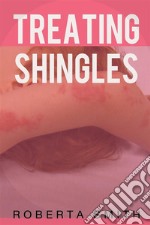 Treating Shingles. E-book. Formato Mobipocket