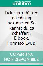 Pickel am Rücken nachhaltig bekämpfen!So kannst du es schaffen!. E-book. Formato EPUB ebook