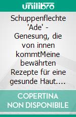Schuppenflechte "Ade" - Genesung, die von innen kommtMeine bewährten Rezepte für eine gesunde Haut. E-book. Formato EPUB ebook