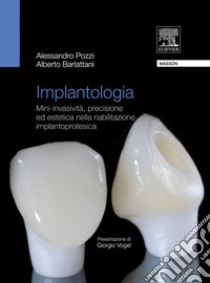 Implantologia estetica. Mini-invasività, precisione ed estetica nella riabilitazione. E-book. Formato EPUB ebook di Alessandro Pozzi