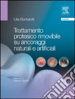 Trattamento protesico rimovibile su ancoraggi naturali e artificiali. E-book. Formato EPUB ebook