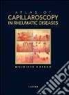 Atlas of capillaroscopy in rheumatic diseases. E-book. Formato EPUB ebook di Maurizio Cutolo