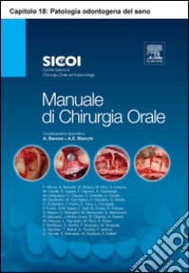 Patologia odontogena del seno mascellare (ECAP018). Estratto. E-book. Formato EPUB ebook