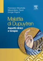 Malattia di Dupuytren. E-book. Formato EPUB ebook