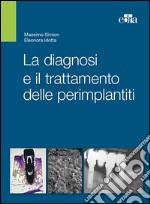 La diagnosi e il trattamento delle perimplantiti. E-book. Formato EPUB ebook