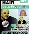 Hair loss prevention. E-book. Formato PDF ebook