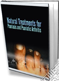 Natural treatments for psoriasis and psoriatic arthritis. E-book. Formato PDF ebook di Ouvrage Collectif