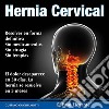 Hernia cervicalLa solución definitiva. E-book. Formato PDF ebook