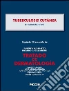 Tuberculosis cutánea. Capítulo 32 extraído de Tratado de dermatología. E-book. Formato EPUB ebook di Cerimele Decio
