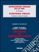 Infecciones virales de la piel--Exantemas virales. Capítulo 41 extraído de Tratado de dermatología. E-book. Formato EPUB ebook