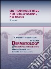 Erythema multiforme and toxic epidermal necrolysis. Chapter 71 taken from Textbook of dermatology & sexually trasmitted diseases. E-book. Formato EPUB ebook