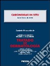 Carcinomas in situ. Capítulo 90 extraído de Tratado de dermatología. E-book. Formato EPUB ebook di D. Cerimele