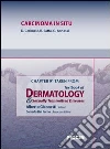Carcinoma in situ. Chapter 91 taken from Textbook of dermatology & sexually trasmitted diseases. E-book. Formato EPUB ebook di D. Cerimele
