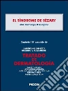 El síndrome de Sézary. Capítulo 101 extraído de Tratado de dermatología. E-book. Formato EPUB ebook di M. G. Bernengo