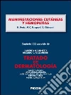 Manifestaciones cutáneas y hemopatías. Capítulo 122 extraído de Tratado de dermatología. E-book. Formato EPUB ebook di K. Peris