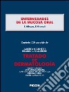 Enfermedades de la mucosa oral. Capítulo 129 extraído de Tratado de dermatología. E-book. Formato EPUB ebook
