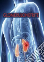 Glomerulonefrite. E-book. Formato EPUB ebook