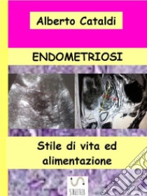 Endometriosi: Stile di vita ed alimentazione. E-book. Formato EPUB ebook di Alberto Cataldi