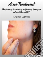 Acne Treatment. E-book. Formato EPUB ebook