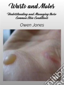 Warts And MolesUnderstanding And Managing These Common Skin Conditions. E-book. Formato EPUB ebook di Owen Jones