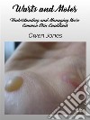 Warts And MolesUnderstanding And Managing These Common Skin Conditions. E-book. Formato EPUB ebook