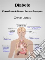 DiabeteIl Problema Dello Zucchero Nel Sangue.... E-book. Formato EPUB ebook