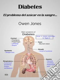 DiabetesEl Problema Del Azúcar En La Sangre.... E-book. Formato EPUB ebook