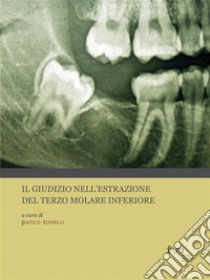 Il giudizio nell’estrazione del terzo molare inferiore. E-book. Formato PDF ebook di Paolo Tonelli