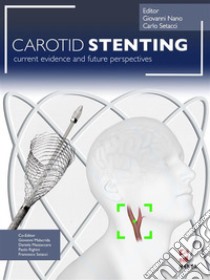 Carotid Stenting. E-book. Formato PDF ebook di Giovanni Nano