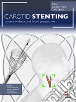 Carotid Stenting. E-book. Formato PDF