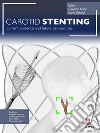 Carotid Stenting. E-book. Formato PDF ebook