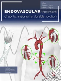 Endovascular treatment of aortic aneurysms: durable solution. E-book. Formato PDF ebook di Giovanni Nano