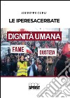 Le iperesacerbate. E-book. Formato PDF ebook