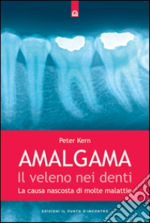 Amalgama: il veleno nei denti: La causa nascosta di molte malattie. E-book. Formato EPUB ebook di Peter Kern