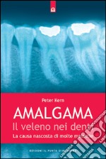 Amalgama: il veleno nei denti: La causa nascosta di molte malattie. E-book. Formato EPUB ebook