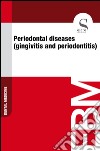 Periodontal diseases (gingivitis and periodontitis). E-book. Formato EPUB ebook