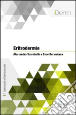 Eritrodermie. E-book. Formato EPUB ebook