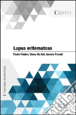 Lupus eritematoso. E-book. Formato EPUB ebook