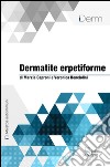 Dermatite erpetiforme. E-book. Formato EPUB ebook di Marzia Caproni