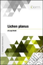 Lichen planus. E-book. Formato EPUB ebook