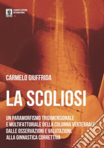 La ScoliosiUn paraformismo tridimensionale e multifattoriale della colonna vertebrale: dalle osservazioni e valutazioni alla ginnastica correttiva. E-book. Formato EPUB ebook di Carmelo Giuffrida