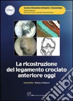 La ricostruzione del legamento crociato anteriore oggi. E-book. Formato PDF ebook