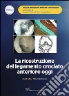 La ricostruzione del legamento crociato anteriore oggi. E-book. Formato PDF ebook di Zaffagnini S. (cur.)