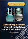 Meniscal replacement. Allograft implantation and synthetic substitution. E-book. Formato PDF ebook di René Verdonk