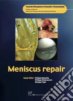 Meniscus repair. E-book. Formato PDF ebook