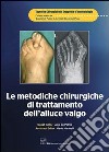 Le metodiche chirurgiche di trattamento dell'alluce valgo. E-book. Formato PDF ebook di De Palma L. (cur.)