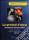 La protesi d'anca nel paziente giovane attivo. E-book. Formato PDF ebook