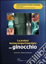 La protesi monocompartimentale del ginocchio. E-book. Formato PDF ebook